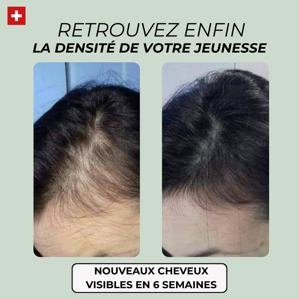 Shampoing repousse active