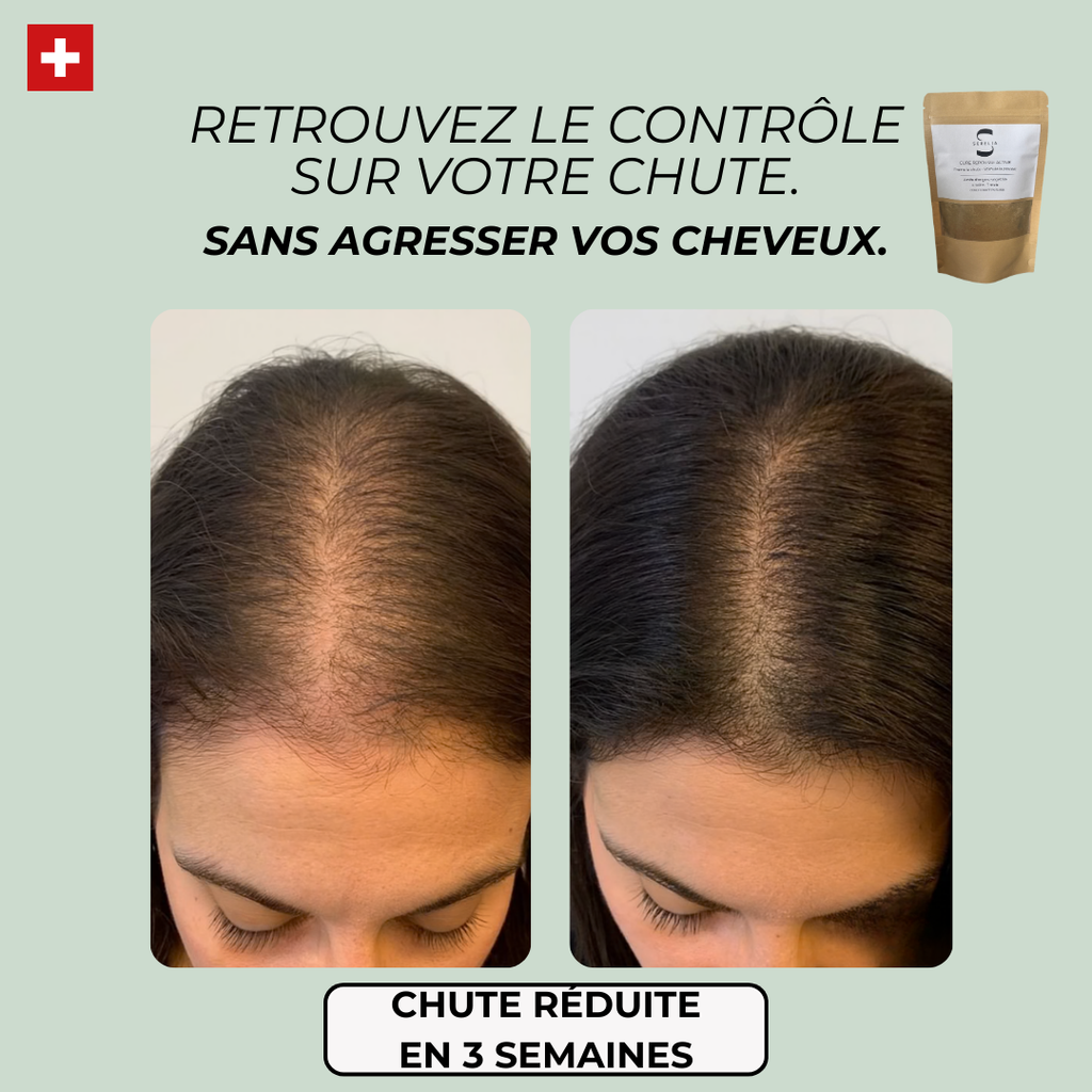Cure Repousse Active