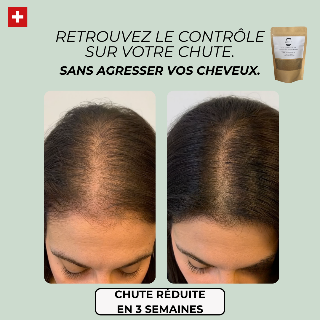 Cure Repousse Active