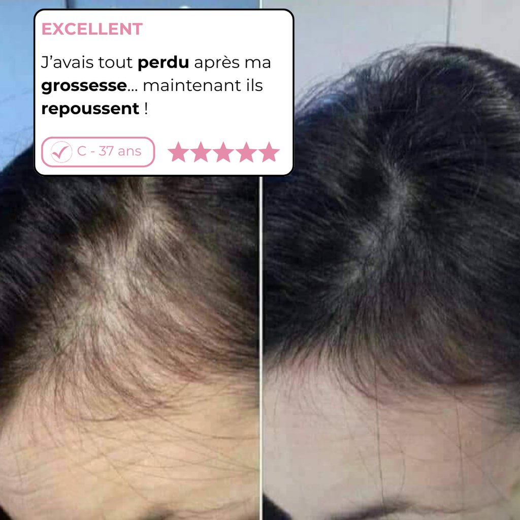 Cure Repousse Active