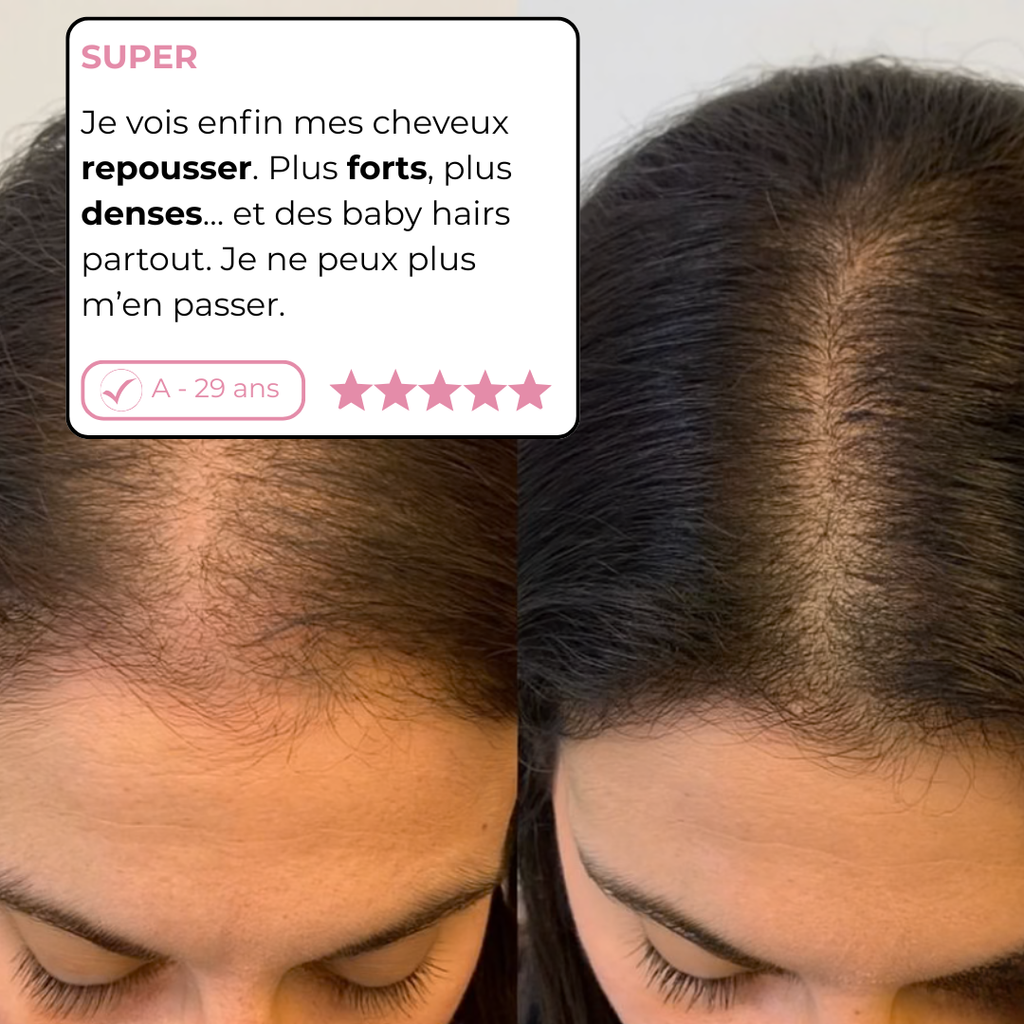 Cure Repousse Active